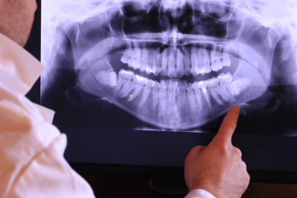 Best Emergency Treatment for Oral Infections in Vermilion, OH